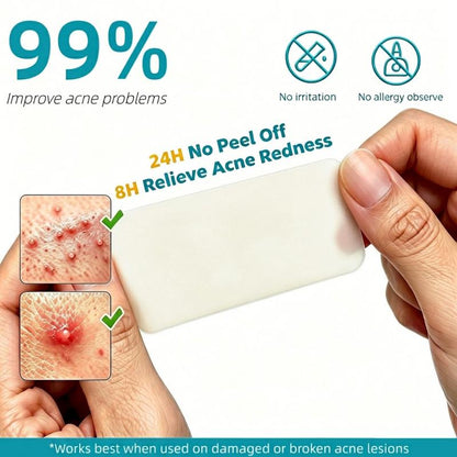 VeyroNova™ | Hydrocolloid Roll